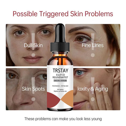 TRSTAY Nicotinamide Essence Can Remove Black Spots, Whiten And Brighten Pores, Shrink Hyaluronic Acid Collagen