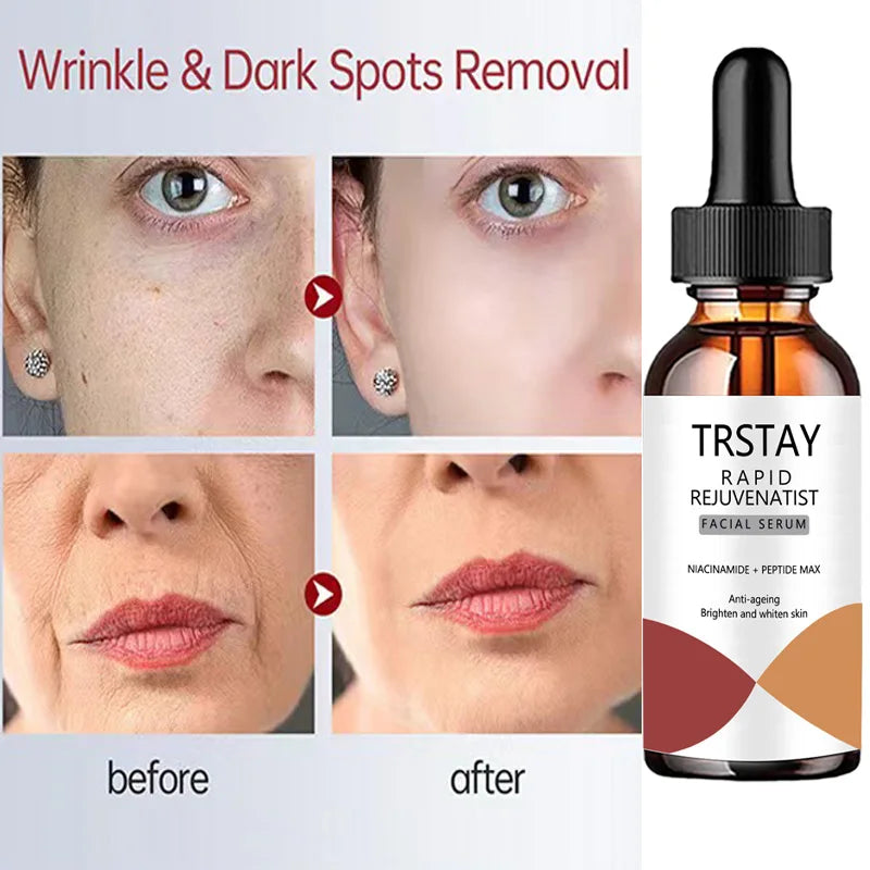 TRSTAY Nicotinamide Essence Can Remove Black Spots, Whiten And Brighten Pores, Shrink Hyaluronic Acid Collagen