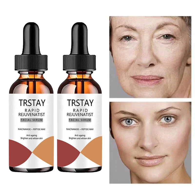 TRSTAY Nicotinamide Essence Can Remove Black Spots, Whiten And Brighten Pores, Shrink Hyaluronic Acid Collagen